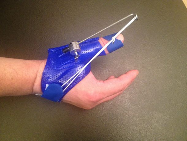 Handtherapie 4 handtherapeutischen Versorgung